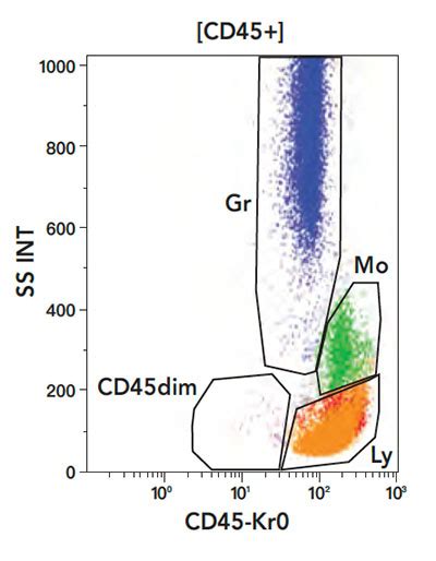 Leukemia and Lymphoma: How Flow Cytometry Aids .